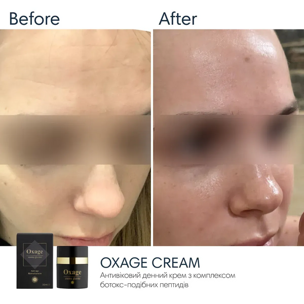 Антивіковий крем з ботокс-ефектом Oxage Cream SPF 30 Braderm 30 мл 00-00000430 - магазин професійної косметики SELENAVI