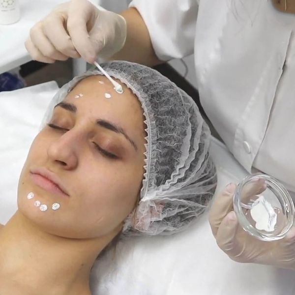Протизапальний підсушуючий засіб Local SOS-Solution Derma Series 100 мл