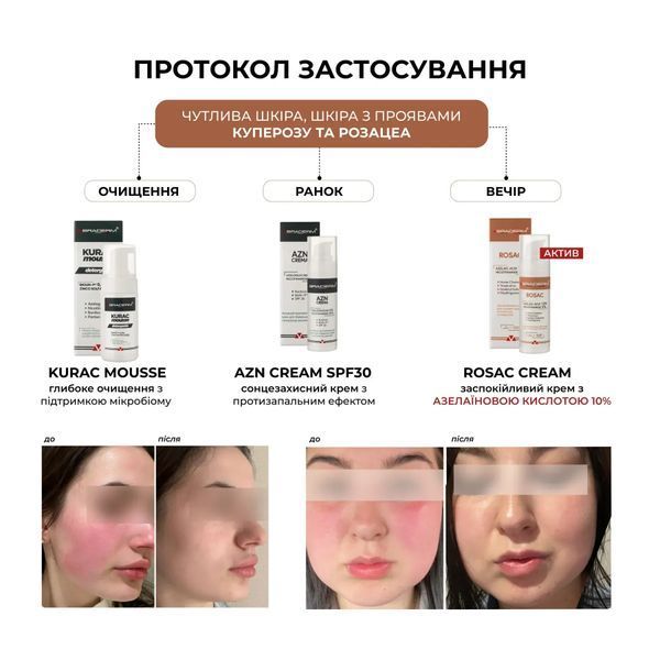 Заспокійливий крем з азелаїновою кислотою Rosac Cream Braderm 30 мл 111 - магазин професійної косметики SELENAVI